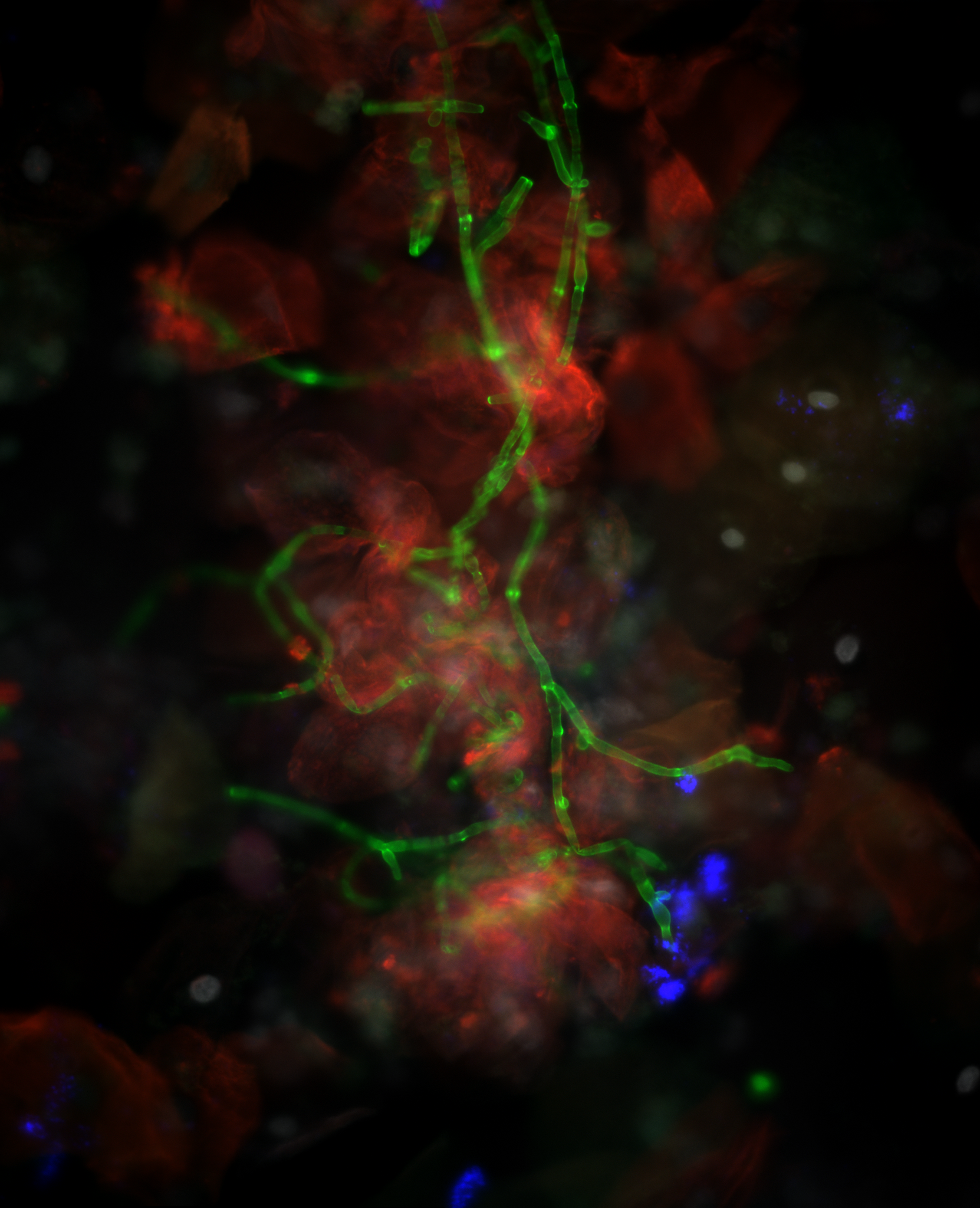 Fluorescent microscopy laboratory research
